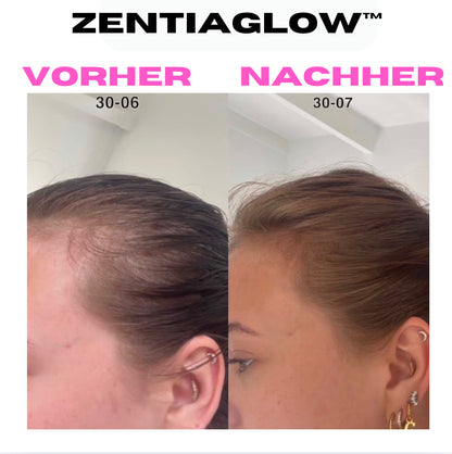 Virales ZentiaGlow™ Haaröl
